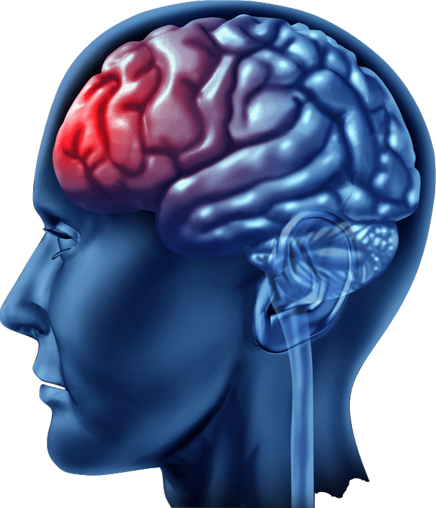 Types of injuries in personal injury accidents